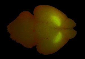 GFP-labeled dorsal striatum in mouse brain. (c) Charles Mazel. Sample photographed at laboratory of Stefano Vicini, Georgetown University. 