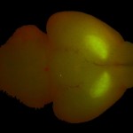 GFP-labeled dorsal striatum in mouse brain. (c) Charles Mazel. Sample courtesy of laboratory of Dr. Stefano Vicini, Georgetown University.