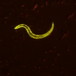 YFP C. elegans