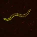 YFP C. elegans. (c) NIGHTSEA/Charles Mazel