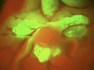GFP tumor in RFP mouse. Composite of green and red fluorescence. (c) Xin Lu, MD Anderson Cancer Center