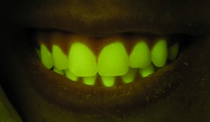 Does it Fluoresce? Your teeth do! (c) Charles Mazel