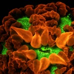 Anemone fluorescing under microscope (c) Charles Mazel