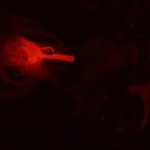 Micro-ruby dye fill of maxillary nerve (c) Robert Mitchell