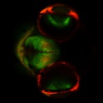 Confocal image of brain of transgenic zebrafish