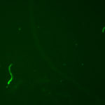 C elegans – GFP in intestines