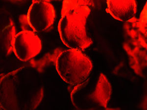 Fungus autofluorescence (c) Rawil Fakhrulin