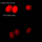 Fluorescence image of RFP positive and negative yellow seeds
