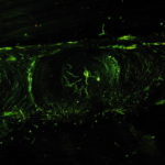 Fluorescent penetrant indication
